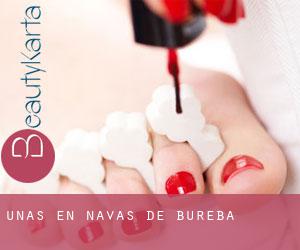 Uñas en Navas de Bureba