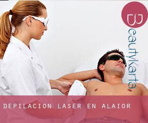 Depilación laser en Alaior