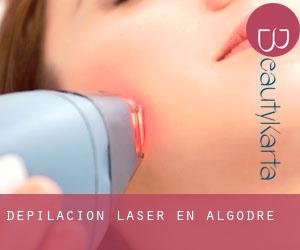 Depilación laser en Algodre