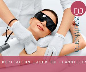 Depilación laser en Llambilles