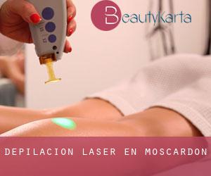 Depilación laser en Moscardón