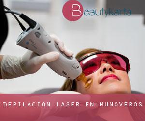 Depilación laser en Muñoveros