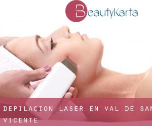 Depilación laser en Val de San Vicente