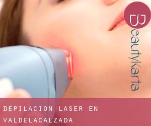 Depilación laser en Valdelacalzada