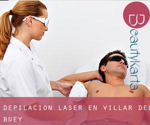 Depilación laser en Villar del Buey