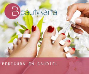 Pedicura en Caudiel